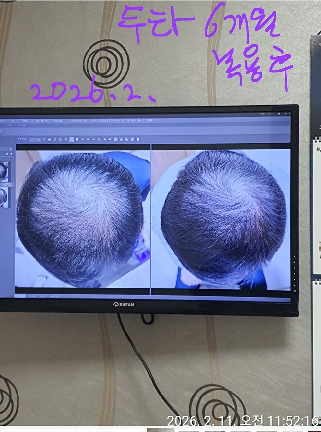 흰머리 염색 하세요?