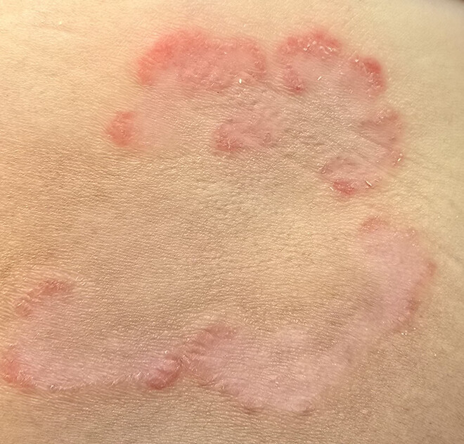 은퇴를 결심하고 매일 바다에 들어가는 이유