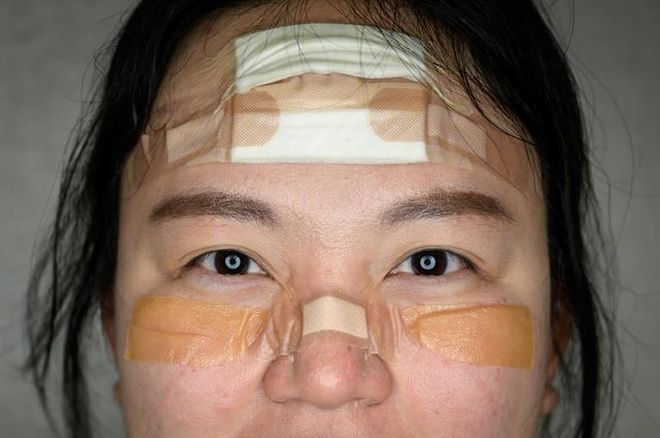 a close up of a woman: The nurses have been lauded for their efforts