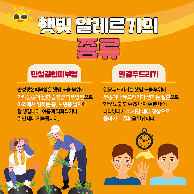 햇빛 알레르기 연고 종류와 선택 기준