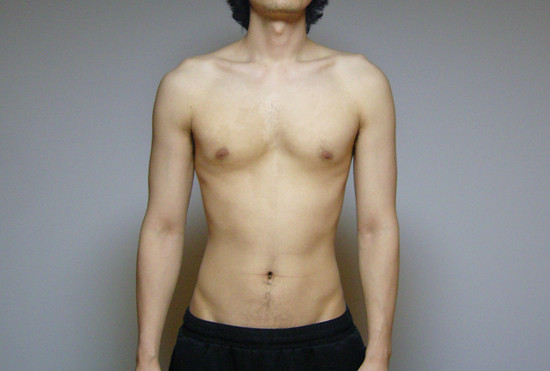 [운동을] 다시 시작합니다.