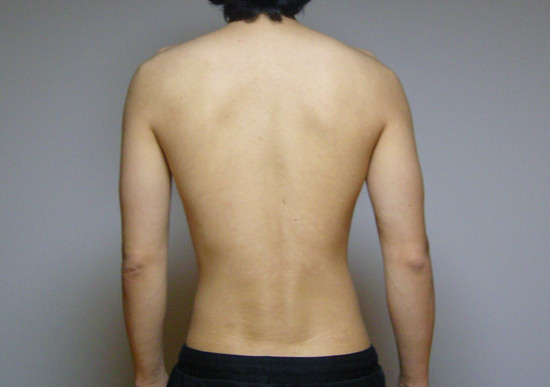 [운동을] 다시 시작합니다.