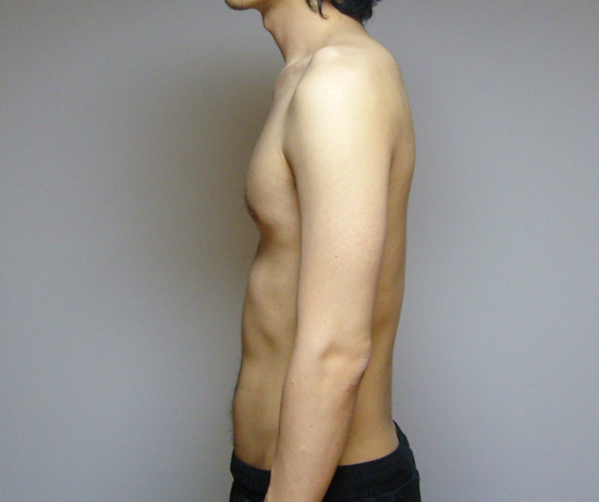 [운동을] 다시 시작합니다.