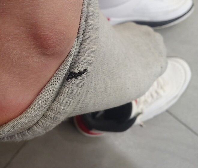 미드나 하이탑 신는데 복숭아뼈 쪽에 통증이 생기네요.