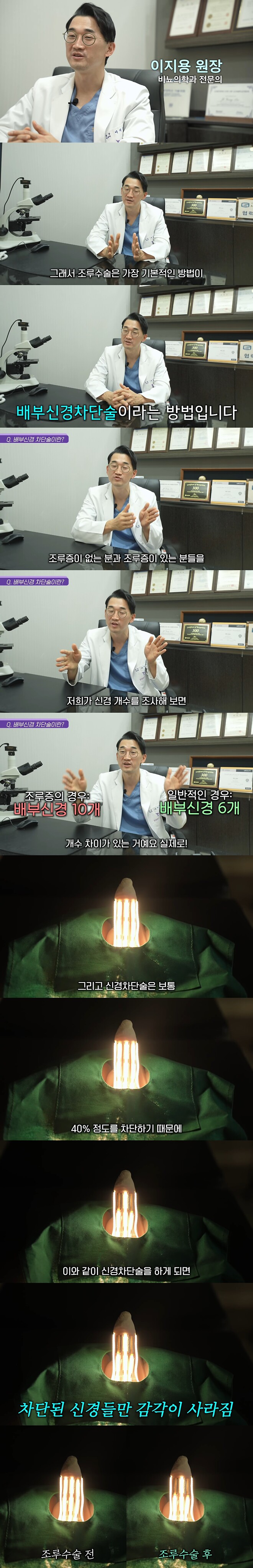 조루는 어떻게 치료할까?