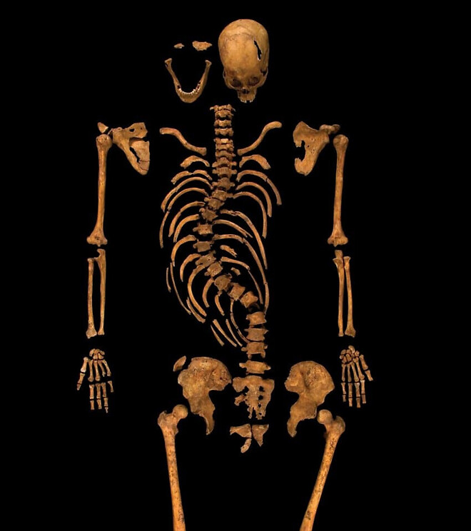 허리가 정말 안좋았던 역사적 인물