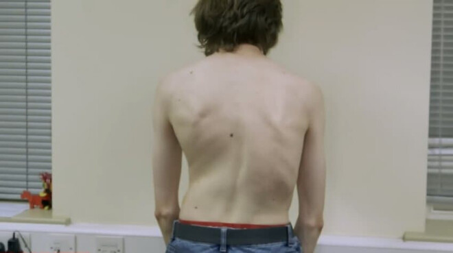 허리가 정말 안좋았던 역사적 인물