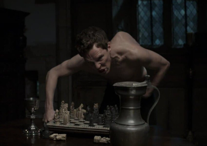 허리가 정말 안좋았던 역사적 인물