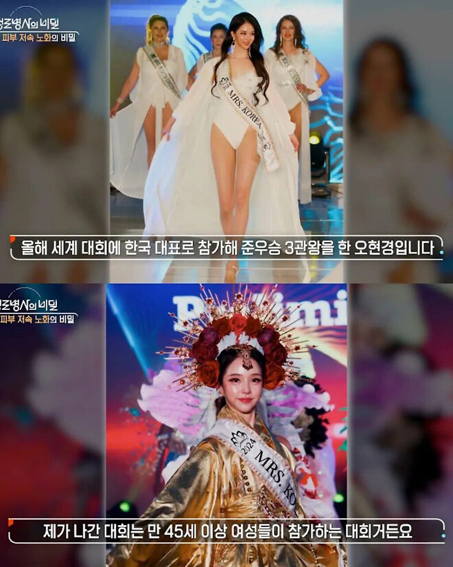 생로병사의 비밀에 나온 동안과 노안