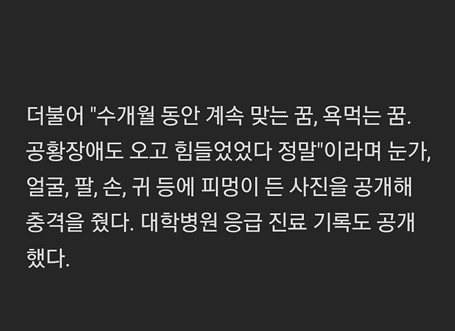 &amp;#039;BJ 성추행 혐의&amp;#039; 유명 걸그룹 오빠, 가정폭력 폭로 &amp;quot;폭행&deg;물고문&amp;quot;