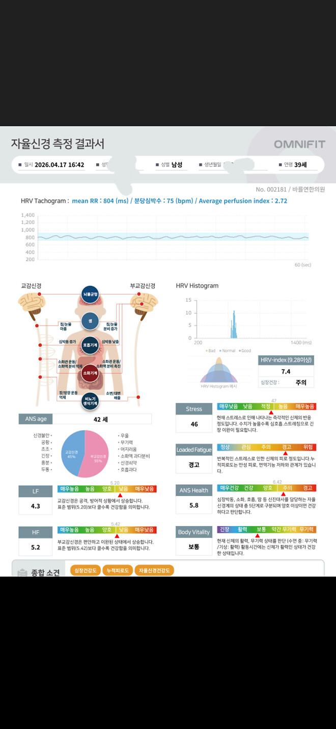 자율신경실조증 아세요?