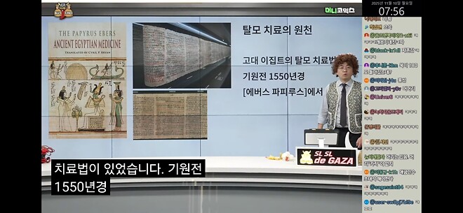 탈모 의 역사 바이킹 즈