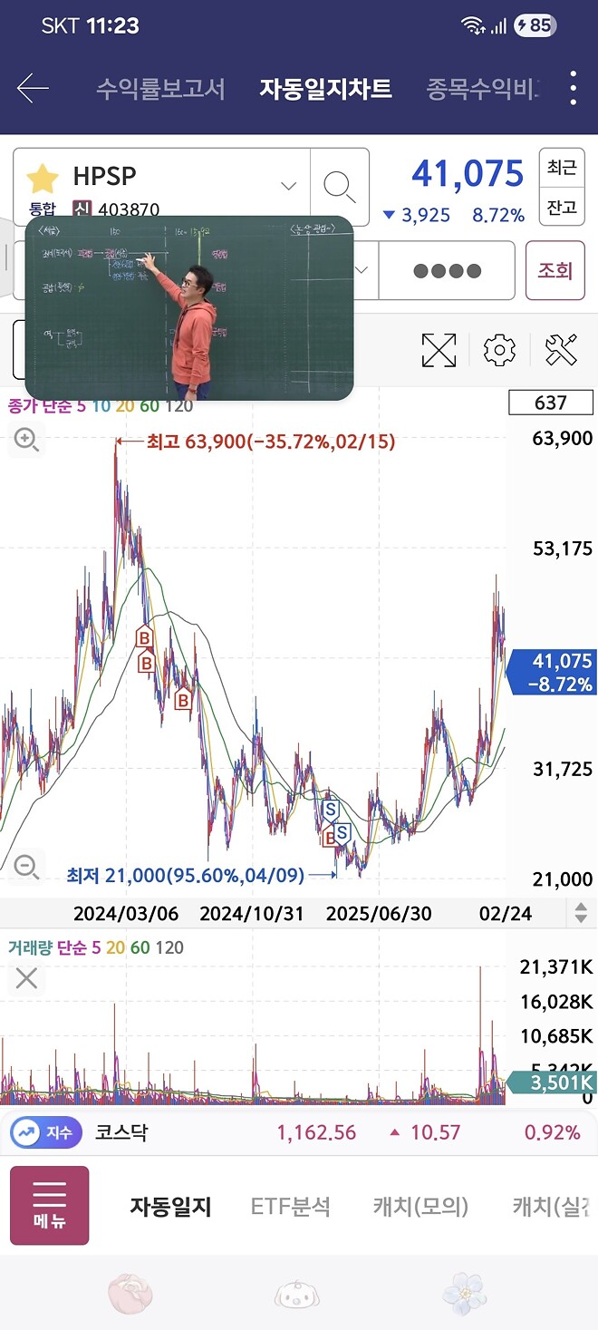 내가 hpsp를 싫어하는 이유