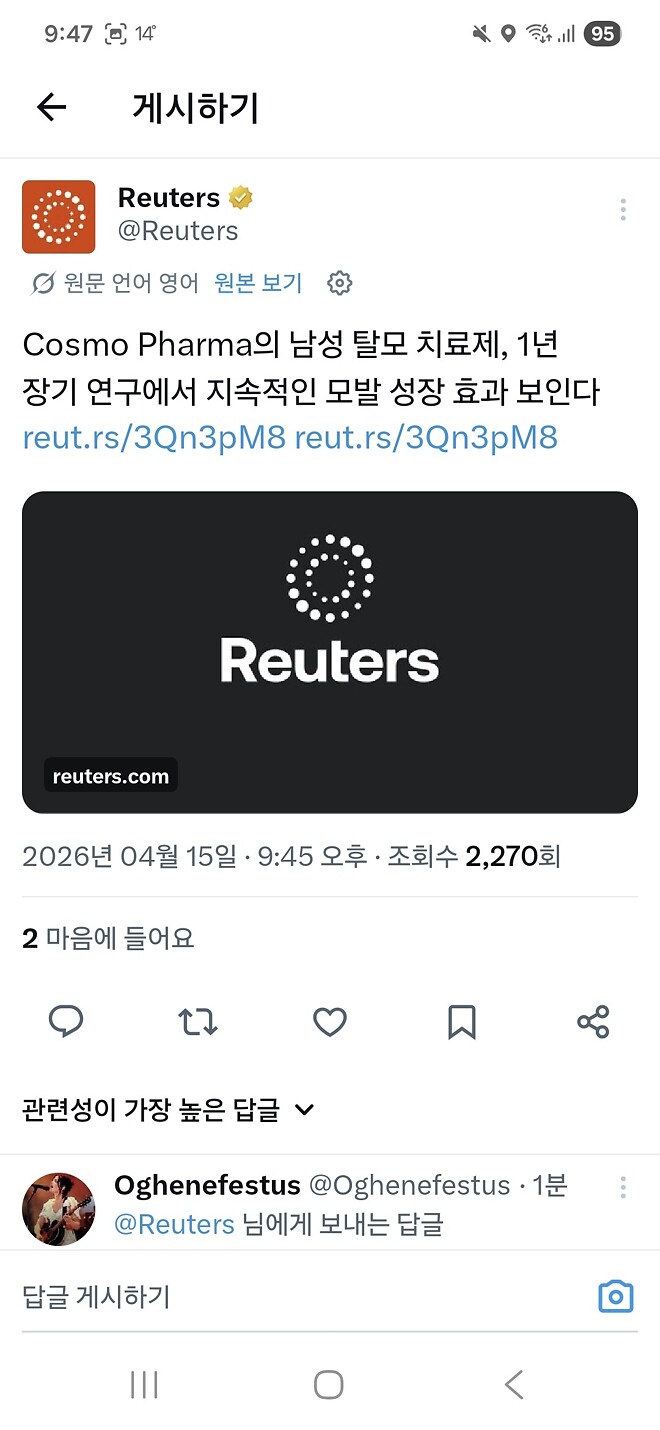 탈모치료제 드뎌 나오나요~~~